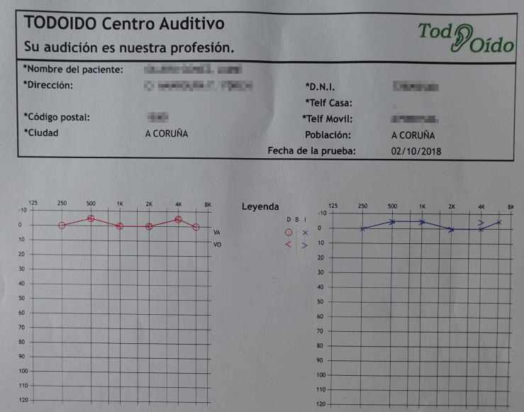 Audiometria