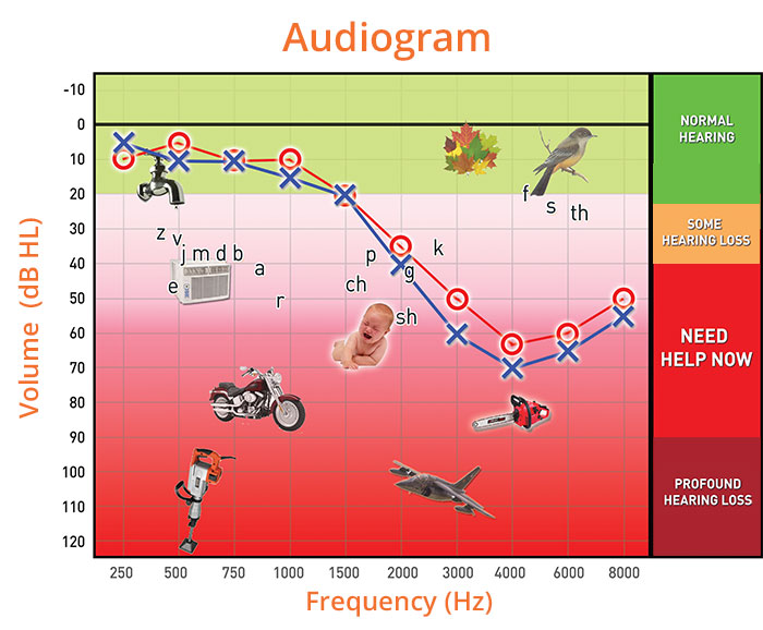 reading-audiogram